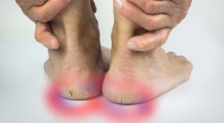 Người già bị đau gót chân: Nguyên nhân và hướng cải thiện