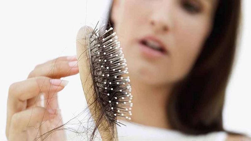 Nguyên nhân khiến tóc rụng thành từng mảng
